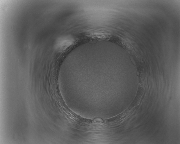 X0000080181297200612151938