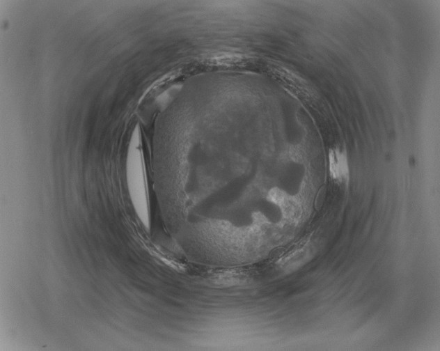 X0000080181155200612221308