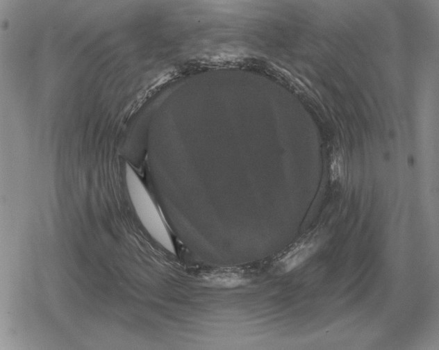 X0000080181156200612221308