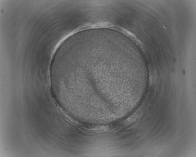 X0000080181174200612221308