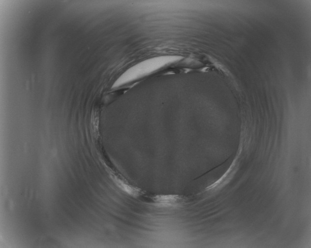 X0000080180192200612302255