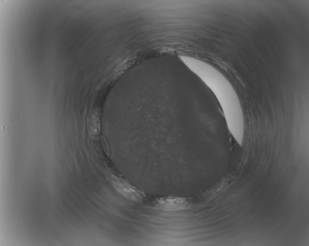 X0000080180517200612302248