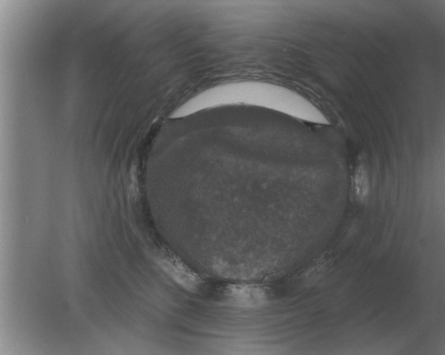 X0000080180520200612302248