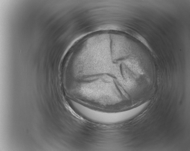 X0000080181116200612302238