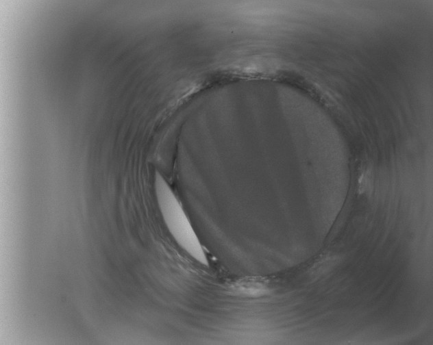 X0000080181156200612302238