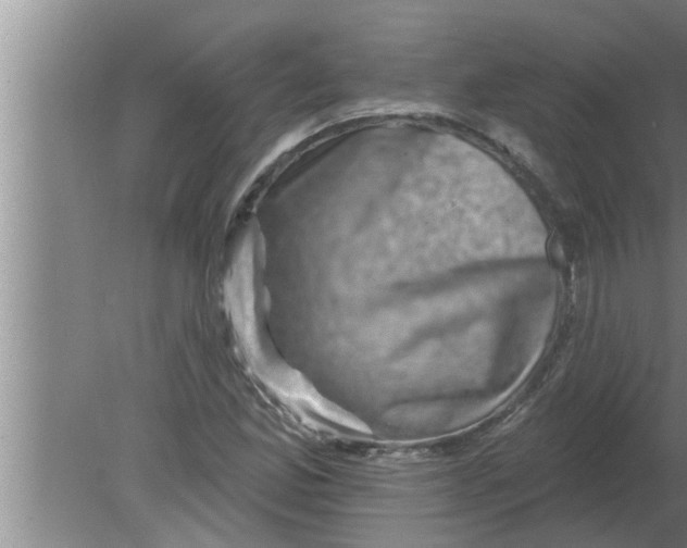 X0000080181165200612302237