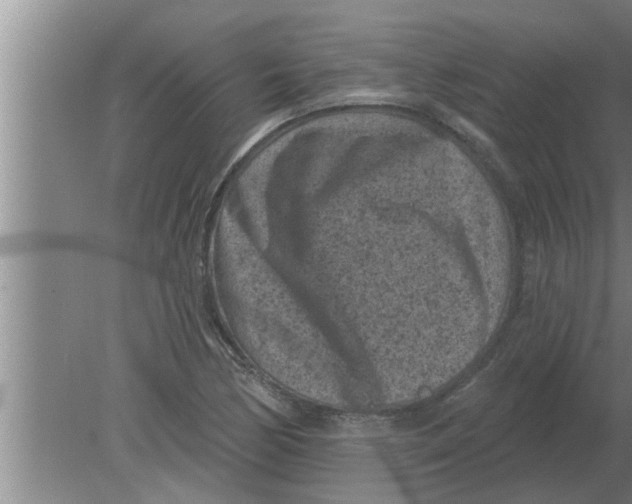 X0000080181170200612302237