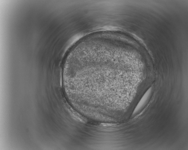 X0000080181171200612302237