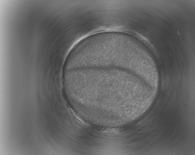 X0000080181174200612302237