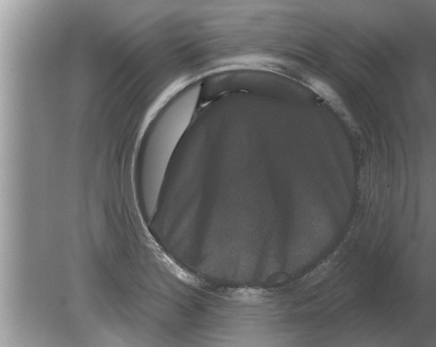 X0000080181180200612302237