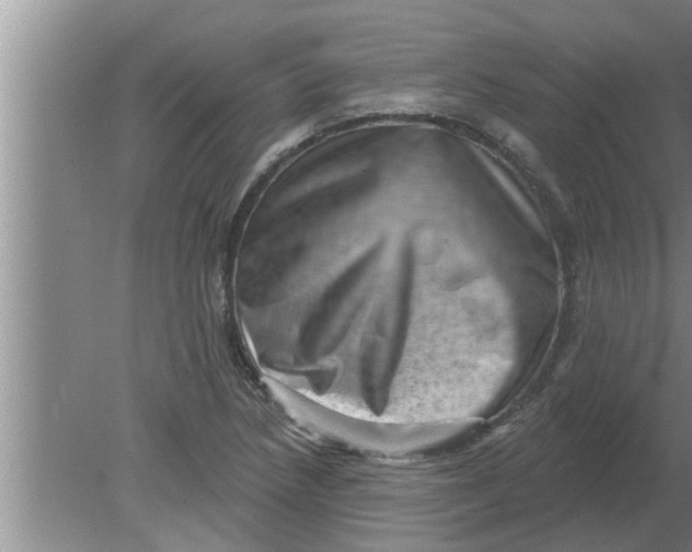 X0000080181218200612302236