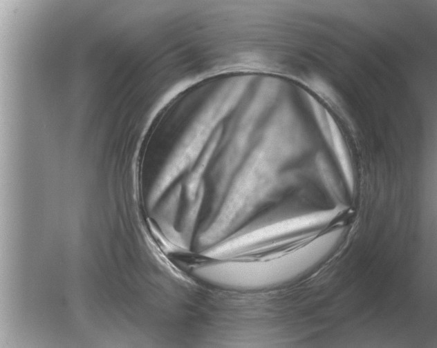 X0000080181238200612302237