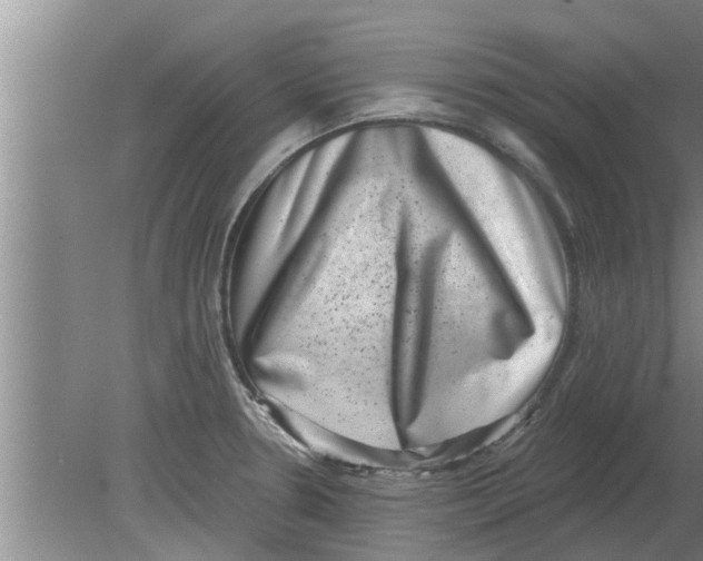 X0000080181330200612302235