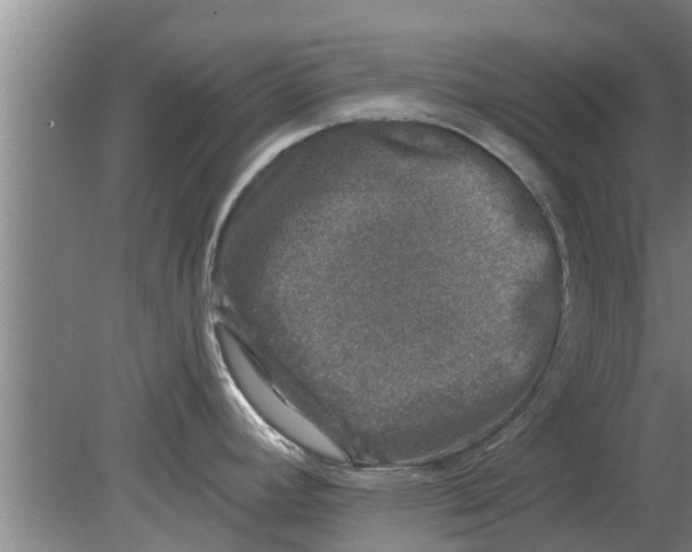 X0000080181392200612302234