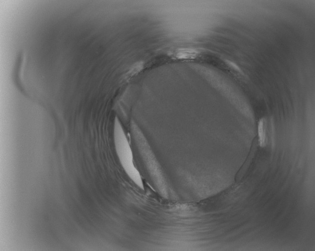 X0000080181443200612302233