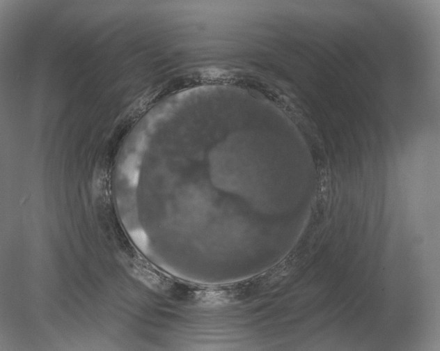 X0000080180419200701051702