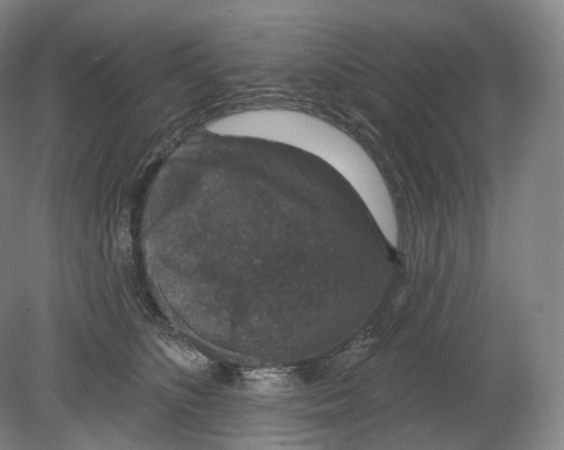 X0000080180516200701051700