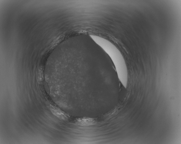 X0000080180517200701051700