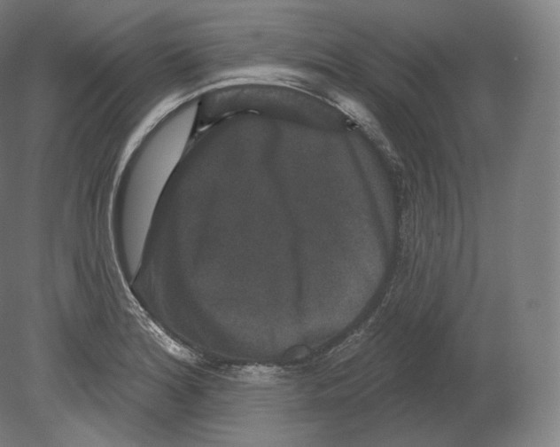 X0000080181180200701051649