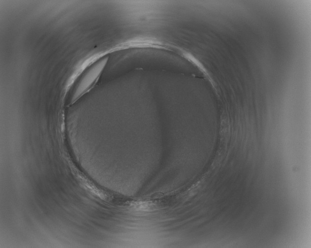 X0000080181461200701051644