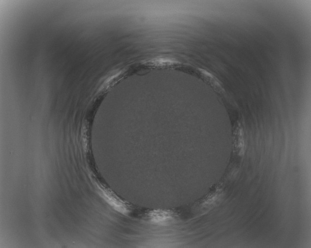 X0000080190762200612152014