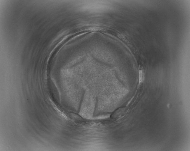 X0000080200243200612302345