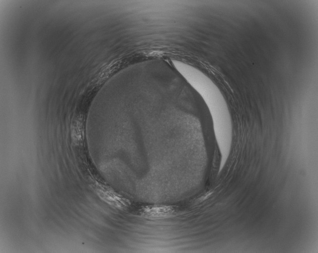 X0000080200517200612302341