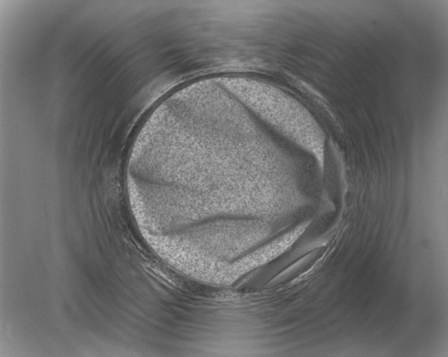 X0000080201170200612302330