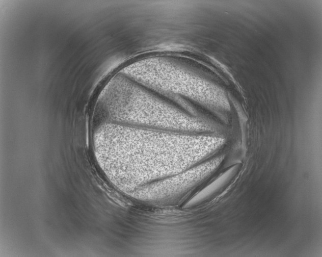 X0000080201171200612302330