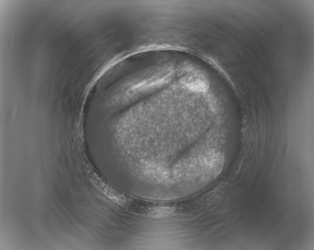 X0000080201173200612302330