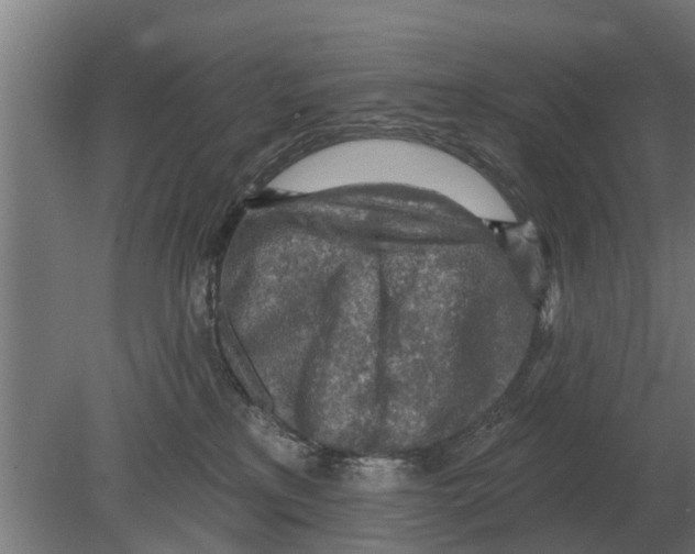 X0000080200233200701051757