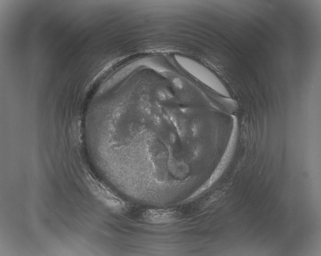 X0000080680351200701051040