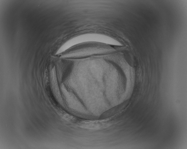 X0000080700029200701121803