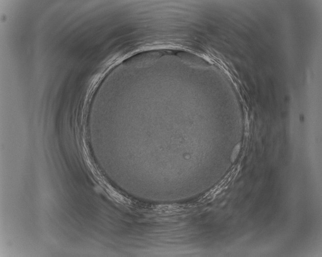 X0000080720145200612151207