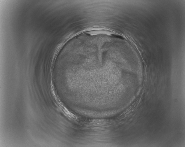 X0000080720145200701021103