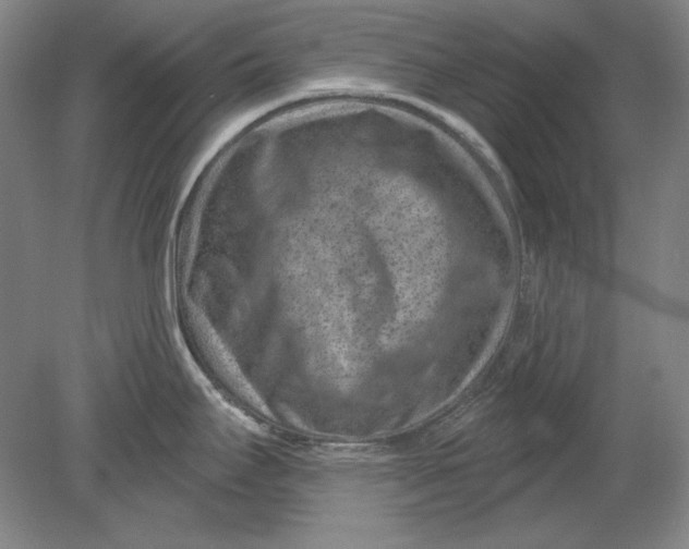 X0000080721295200701021044