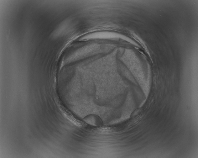 X0000080720059200701121854