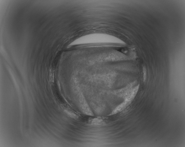 X0000080720180200701121853