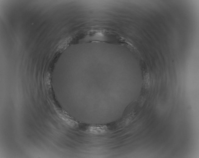 X0000080760571200701051239