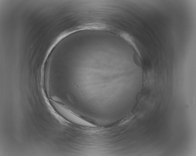 X0000080791099200612151448