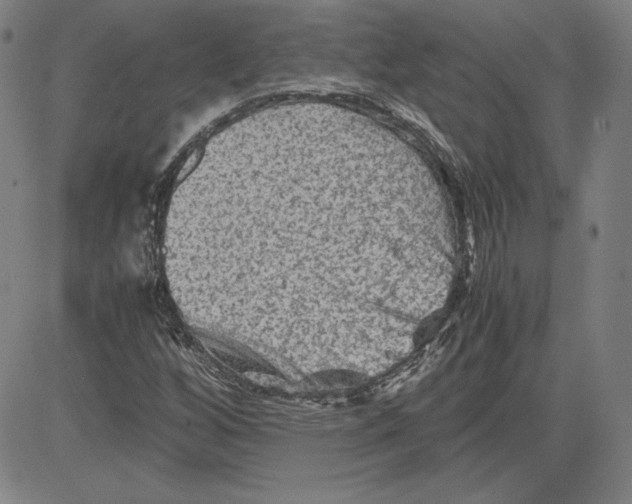 X0000080811256200701051141