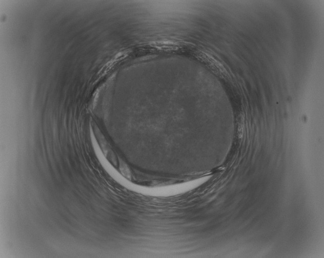 X0000080811298200701051140