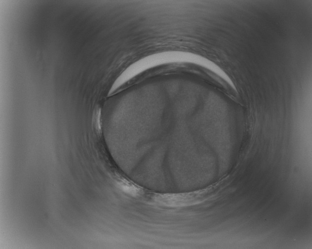 X0000080810041200701122252