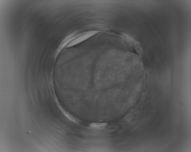 X0000080810051200701122251