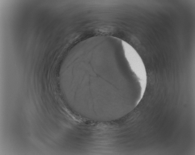 X0000080811009200701122235