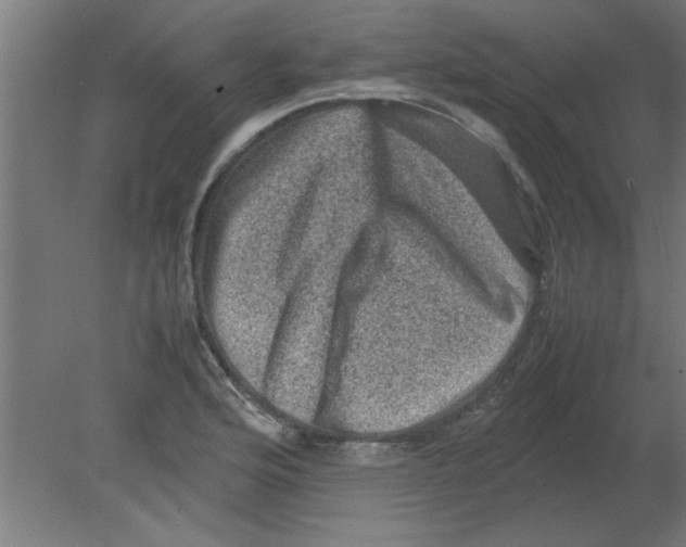 X0000080811176200701122233