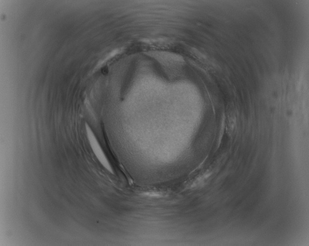 X0000081281010200702012213