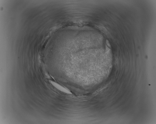 X0000081281106200702012211