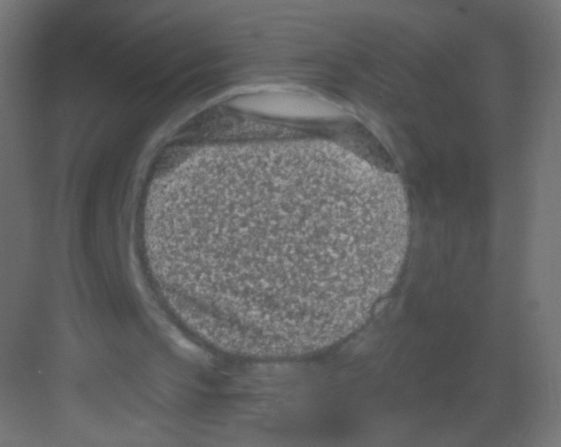 X0000081320145200702082145