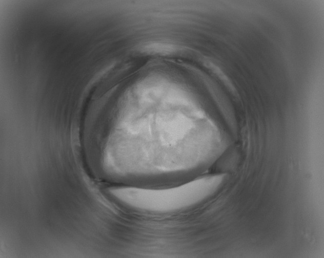 X0000081320399200702082141